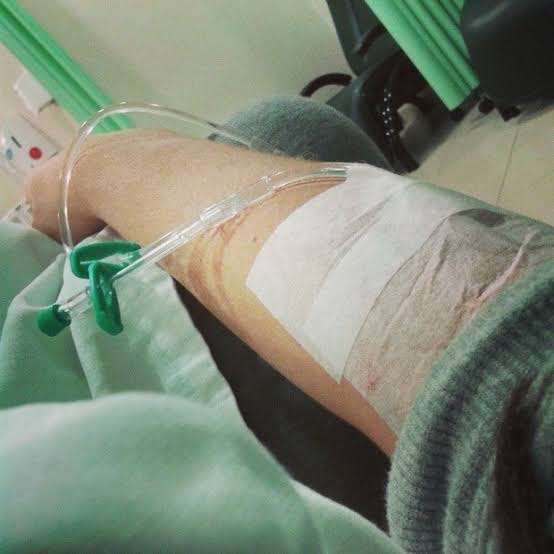 Adolescente morre em hospital no Nordeste após receber buscopan e dipirona na veia; Polícia investiga