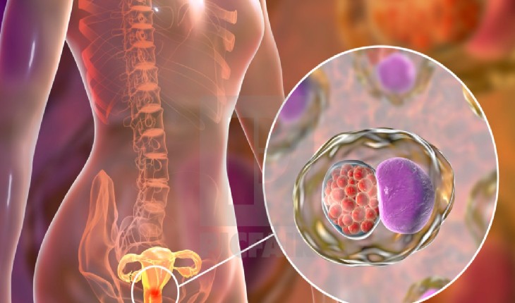 Dor abdominal e gases? 7 sinais de câncer no intestino que não devem ser ignorados