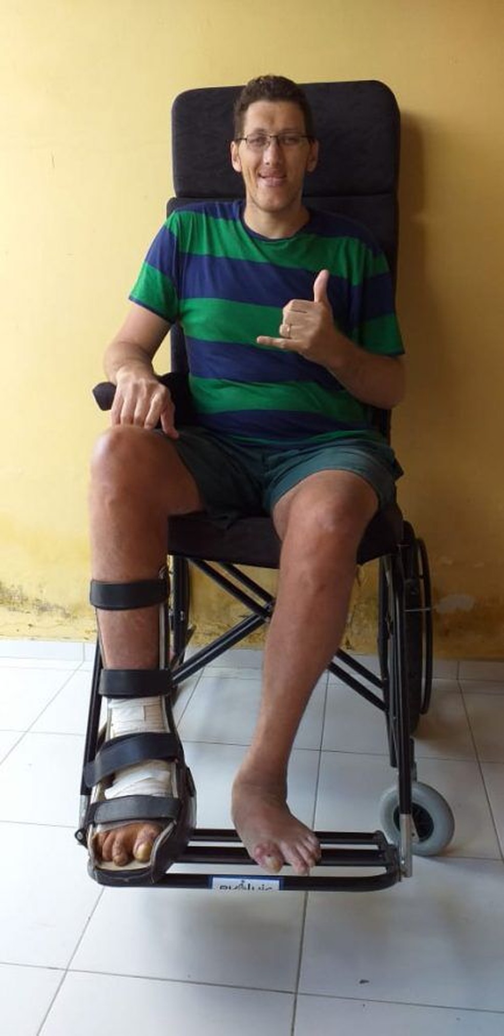 Homem mais alto do Brasil vai amputar perna por causa de infecção: 'decisão dura e dolorosa'