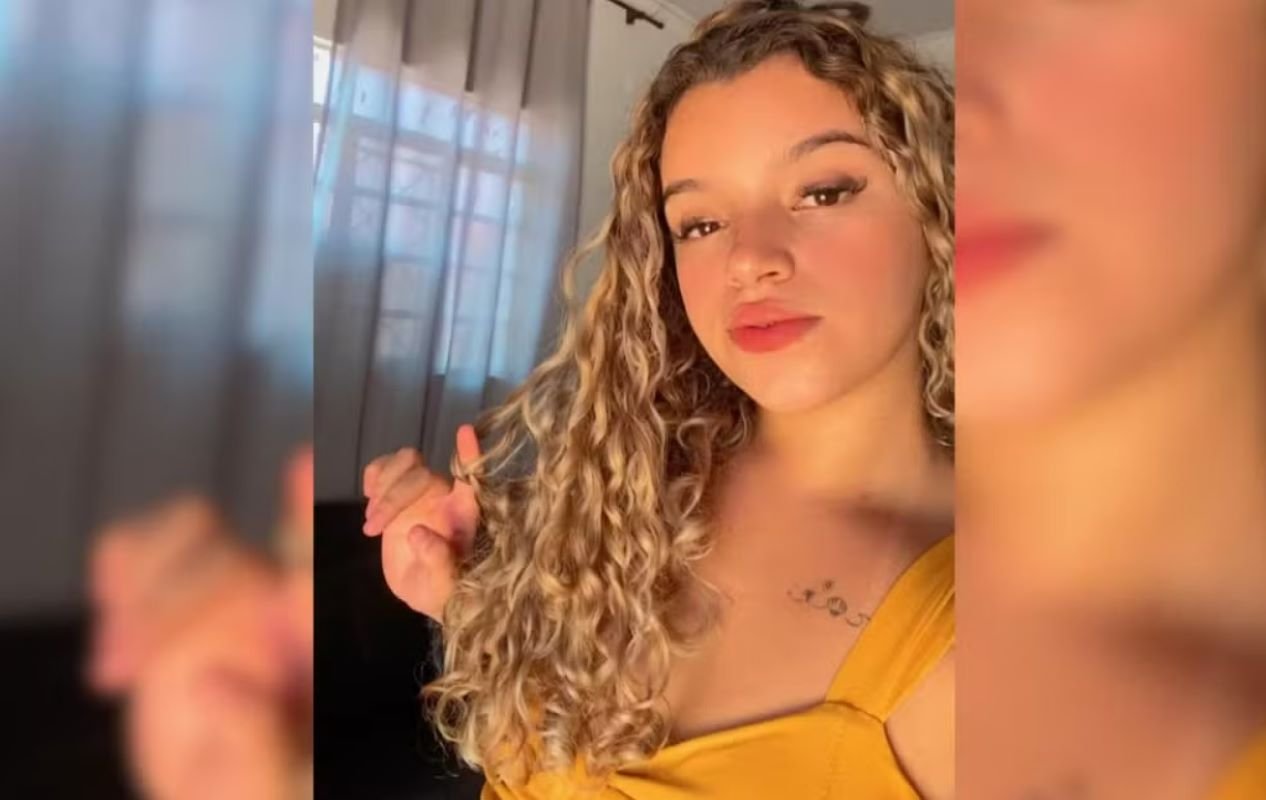 Morre jovem que teve 80% do corpo quelmado enquanto fummava narguilé