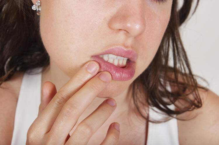 Sabia que é possível pegar uma DST pela boca? Saiba como, os sintomas e prevenções